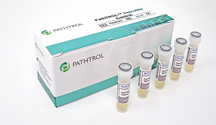 PATHTROL VASCULITIS